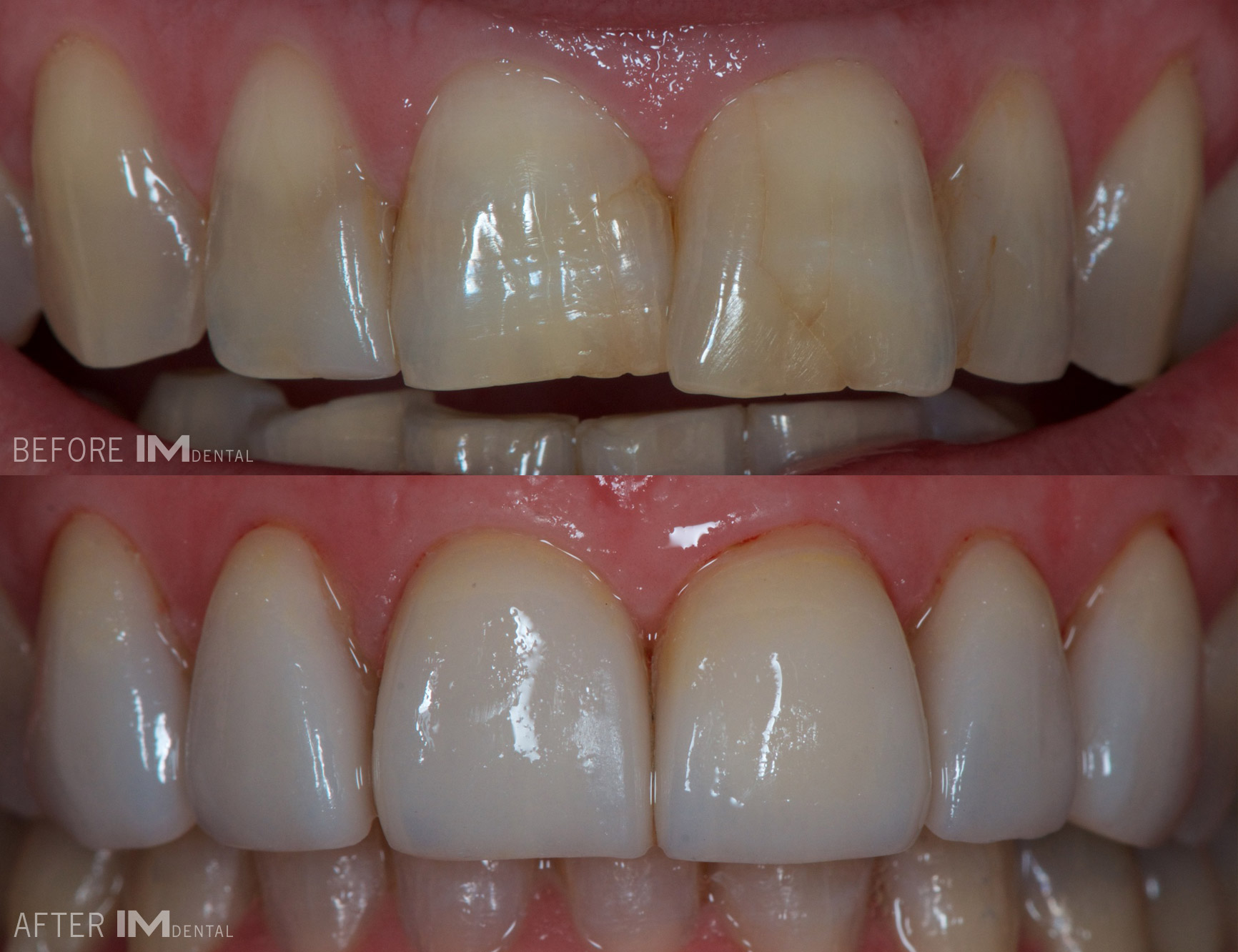 cosmetic dental albury wodonga before and after
